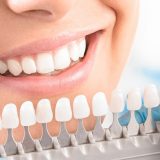 Отбеливание зубов в стоматологии