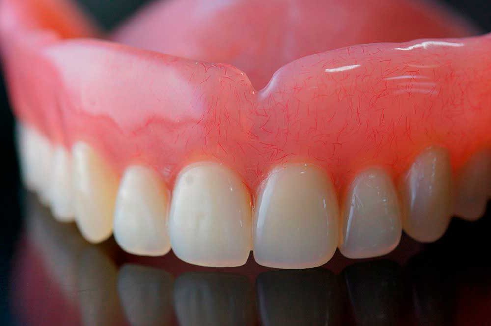Съемные и несъемные протезы зубов